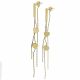 ACERO ARETES