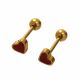 ACERO ARETES