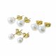 ACERO ARETES