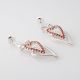 Aretes