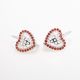 Aretes